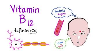 Vitamin B12 Cobalamin Deficiency  Causes Symptoms Diagnosis amp Management  Hematology Series [upl. by Chard900]