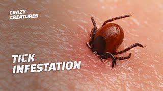 WARNING The Most Horrific Tick Infestations [upl. by Aiselad]