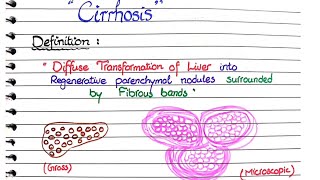 Cirrhosis of Liver  Pathology [upl. by Arzed]