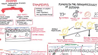 Asthma  signs and symptoms pathophysiology [upl. by Anelrac951]