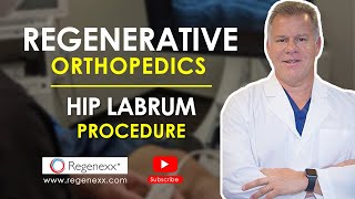 Slap Tear Anterior Labrum Rehabilitation  No Surgery  Phase 1 [upl. by Mufi213]