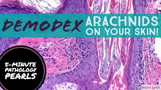 Demodex Tiny Arachnids living on your skin [upl. by Prasad]