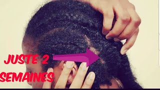 COMMENT FAIRE POUSSER SES CHEVEUX PLUS VITE JUSTE EN 2 SEMAINES [upl. by Durante]